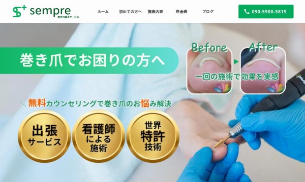 sempre巻き爪補正サービス