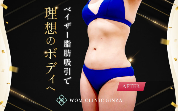株式会社NOBUの実績 - ベイザー脂肪吸引ver.2　Wom clinic Ginza様